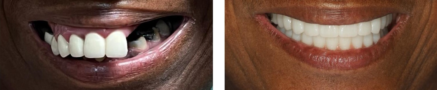 Before and after example 1