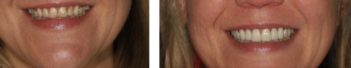 Before and after example 3